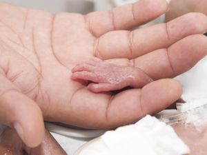 Bayi Lahir dengan Bobot Rendah Berisiko 15 Persen Alami Tubuh Pendek