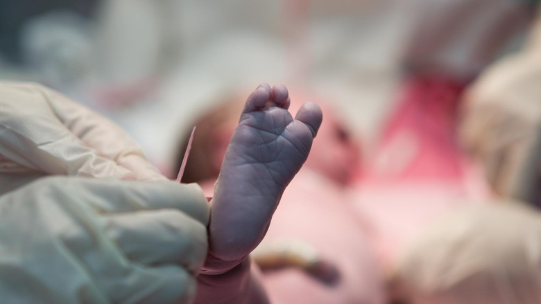 Melahirkan Caesar, Ibu Ini Tarik Sendiri Bayinya Keluar, Bun/ Foto: Thinkstock Melahirkan Caesar, Ibu Ini Tarik Sendiri Bayinya Keluar, Bun/ Foto: Thinkstock