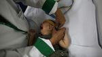 Lucas dan Laura, Bayi Kembar Unik di Brazil yang Jadi Kunci Kalahkan Zika