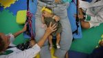 Lucas dan Laura, Bayi Kembar Unik di Brazil yang Jadi Kunci Kalahkan Zika