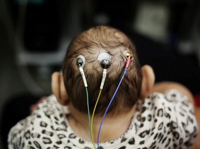 Dua Kasus Infeksi Zika Baru Dilaporkan Lagi di Singapura