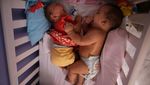 Lucas dan Laura, Bayi Kembar Unik di Brazil yang Jadi Kunci Kalahkan Zika