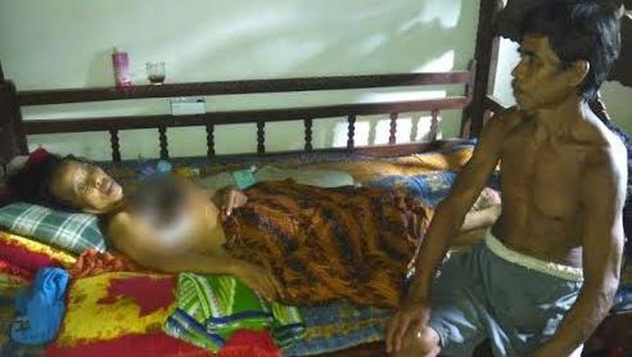 Paini Hanya Terbaring Lemah Digerogoti Kanker Payudara