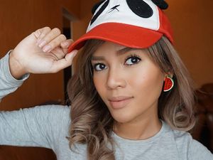 Cerita YouTuber Rachel Goddard, Jerawatan Parah karena Hobi Makan Gorengan