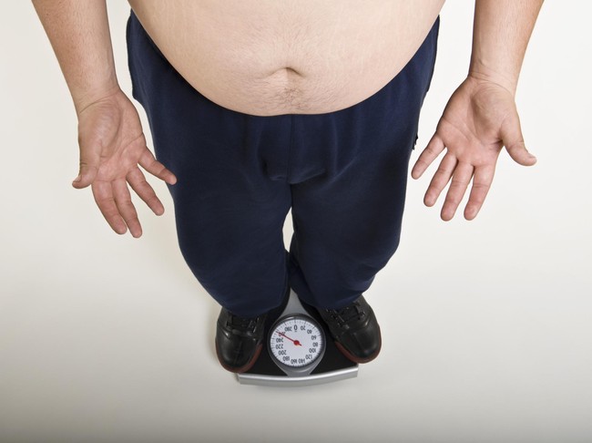 4 Kebijakan untuk Cegah Meningkatnya Kasus Obesitas dan Kegemukan