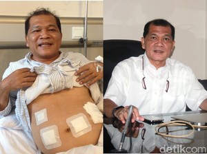 Ayah 1 Anak Ini Sebut Gula Darahnya Lebih Stabil Usai Jalani Bypass Lambung