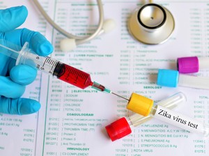 Seberapa Besar Risiko Penularan Zika dari Singapura ke Indonesia? Ini Kata Pakar