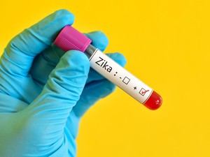 Kemenkes: WNI yang Positif Zika di Taiwan dalam Kondisi Baik