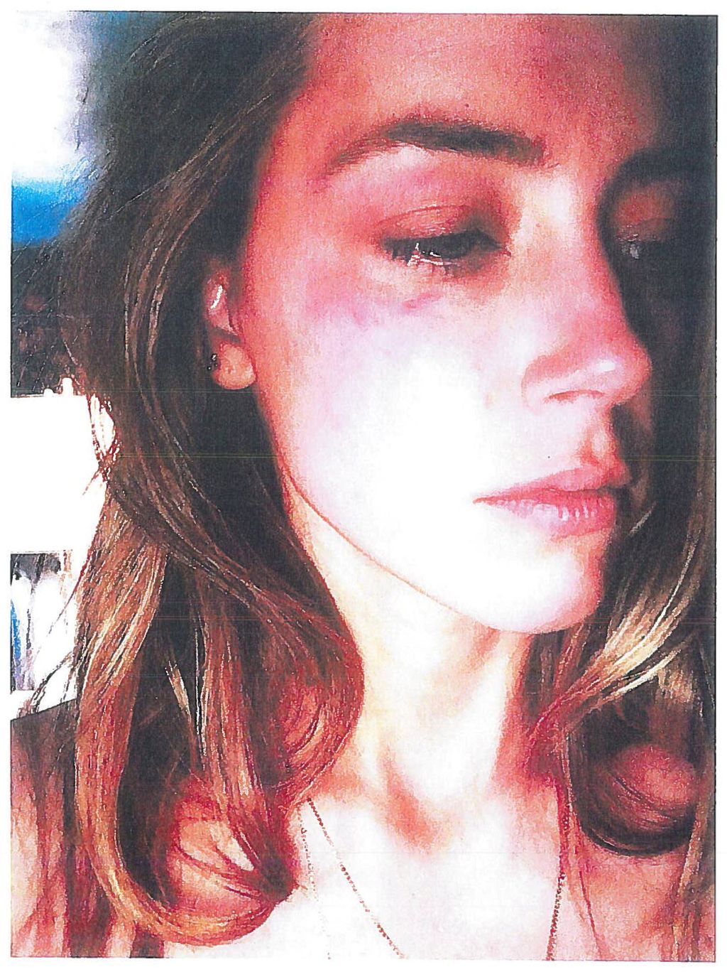 Actress Amber Heard is pictured in Los Angeles, California, U.S. with what appears to be bruising on her right cheek in an undated handout photograph included in a court filing for a restraining order against husband Johnny Depp. Superior Court of Los Angeles/Handout via Reuters ATTENTION EDITORS - THIS IMAGE WAS PROVIDED BY A THIRD PARTY. EDITORIAL USE ONLY     TPX IMAGES OF THE DAY