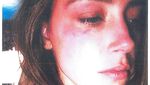 Amber Heard Disebut KDRT Johnny Depp hingga Jarinya Putus