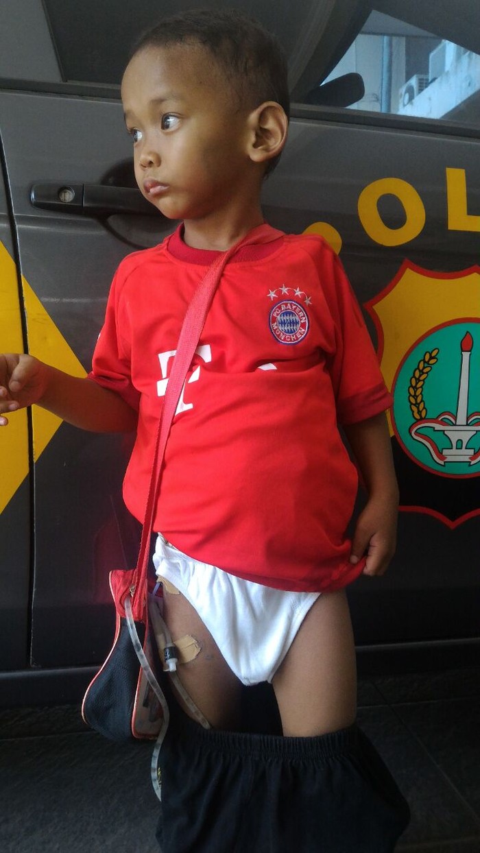 Balita yang Pakai Jersey Munchen di Lenteng Ditemukan Masih Pakai Infus di Paha