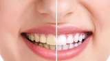 5 Cara Memutihkan Gigi Secara Alami, Bisa Dilakukan di Rumah!