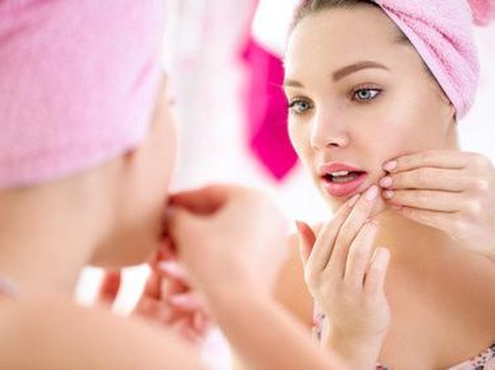 Ini Akibatnya Jika Hobi Memencet-mencet Jerawat