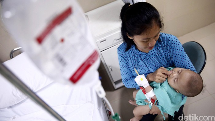 Adakah Cara Mencegah Bibir Sumbing pada Anak Sejak Masa Kehamilan?