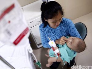 Masih Banyak Anak dengan Bibir Sumbing yang Butuh Bantuan