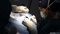 Tim medis melakukan operasi bibir sumbing.