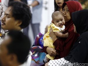 Pesan Dokter Untuk Mencegah Sumbing pada Bibir dan Lelangit