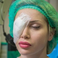 Prosedur operasi mata yang ia lakukan di India itu sangat berisiko. Jika salah langkah, Pixee bisa mengalami kebutaan. Foto: Ist.