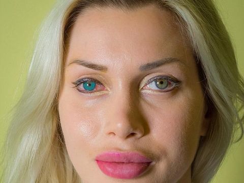 Duh! Wanita Ini Implan Bulu Mata Pakai Rambut Kemaluan 