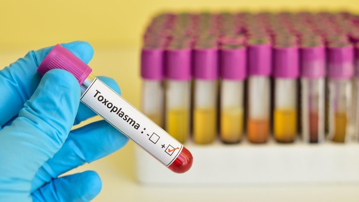 Jangan Khawatir, dengan Perawatan Tepat Toksoplasma Bisa Disembuhkan Kok