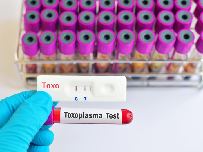 Tak Cuma Kotoran Kucing, Infeksi Tokso Bisa Didapat dari Hal-hal Ini