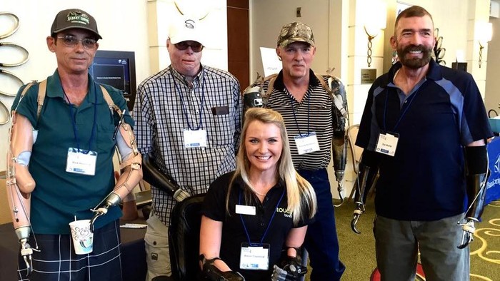 Meski Tubuh Sempat Digerogoti Bakteri Pemakan Daging, Aimee Tetap Semangat