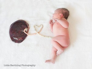 Tren Foto Kelahiran Terbaru: Bayi Pose Bareng Plasenta