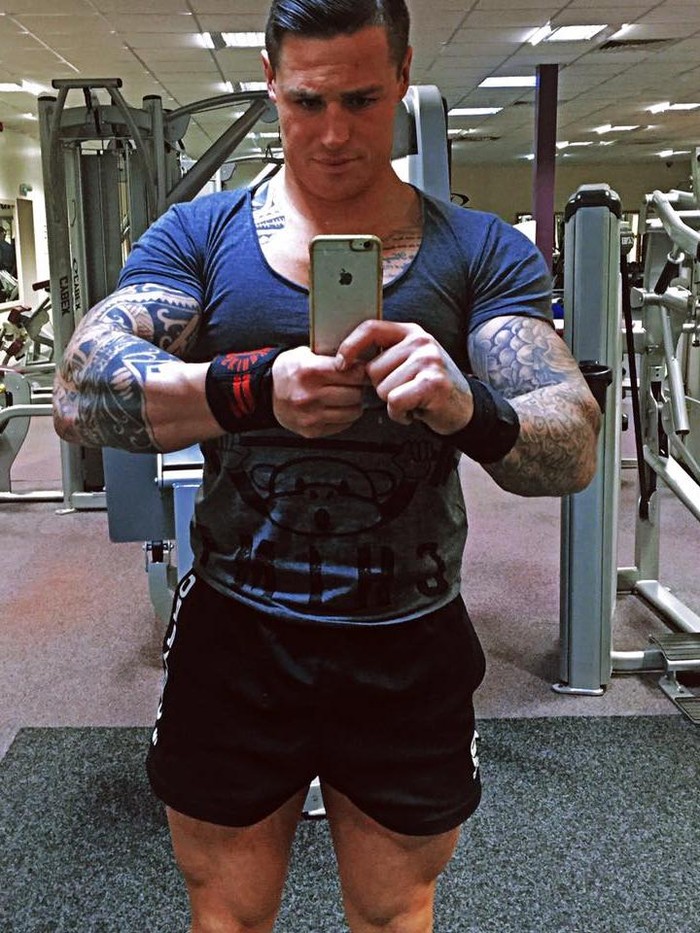 Cerita James, Jadi Tak Bisa Bicara dengan Jelas karena Dystonia