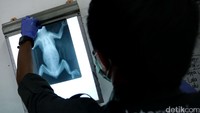 Dokter melihat hasil rontgen kukang.