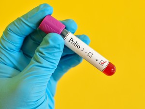 Duh! Virus Polio Kembali Terdeteksi di India