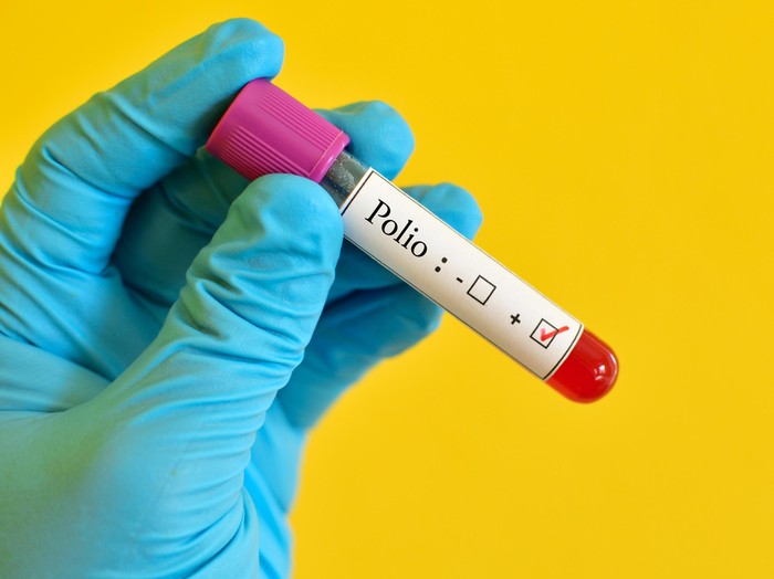 Duh! Virus Polio Kembali Terdeteksi di India