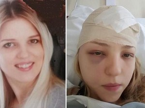 Berusia 27 Tahun, Ibu Muda Ini Sudah Didiagnosis dengan Empat Jenis Kanker