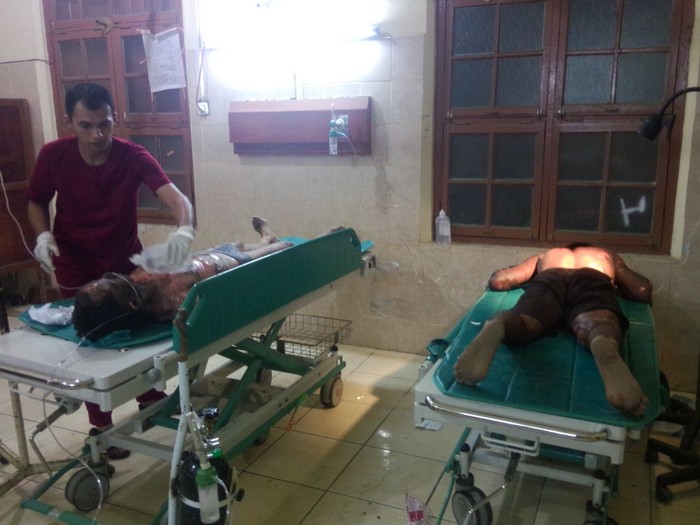 Tambang Batu Bara di Sawahlunto Meledak, 5 Pekerja Alami Luka Bakar