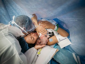 Antenatal Care, Jaminan Pencegah dan Penurun Angka Kematian Ibu di Indonesia