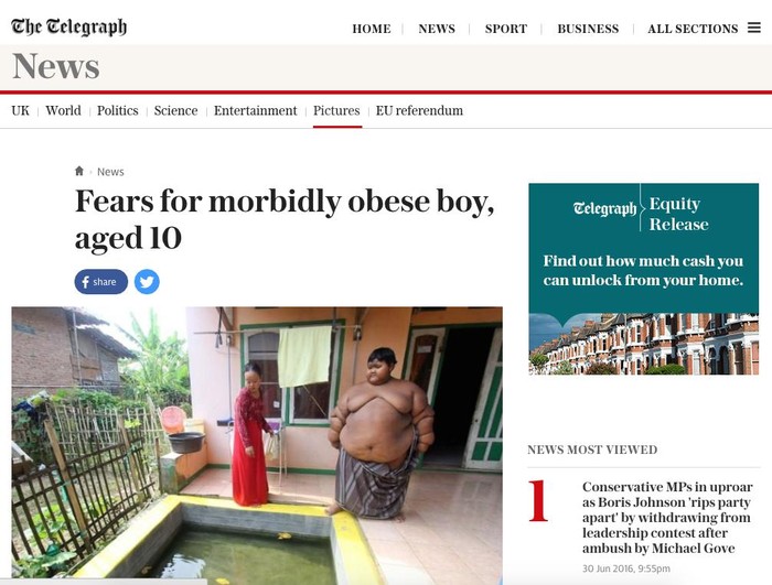 Ariya, Bocah 10 Tahun asal Karawang yang Berbobot 188 Kg Jadi Perhatian Dunia