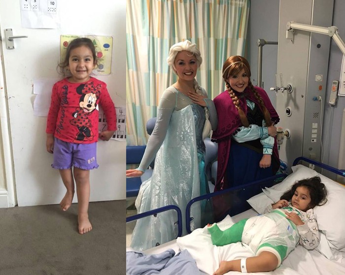 Gadis Kecil Ini Berharap Punya Sepasang Kaki Normal, Begini Perjuangannya