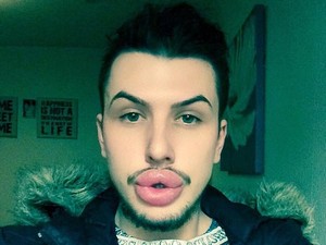 2 Pria Rela Mengubah Wajah Demi Mirip Keluarga Kardashian