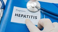 Orang dengan hepatitis biasanya memiliki kuku-kuku yang berwarna putih pekat. Pinggiran kukunya pun ikut berwarna serupa. (Foto: Thinkstock)