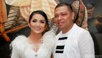 Seleb Pria Dicap Pebinor, Foto Masa Kecil Marion Jola hingga Sosok Nyata Milea