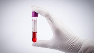 Terungkap Golongan Darah yang Lebih Berisiko Kena Stroke, Ini Alasannya