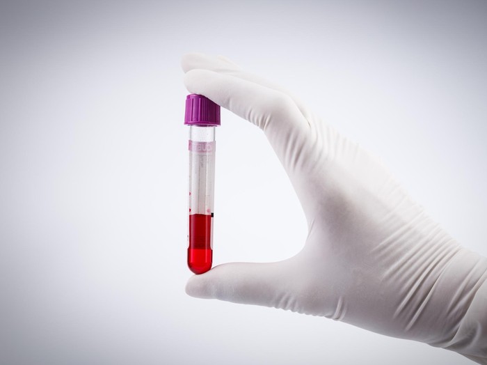 Darah Muda Ini Diklaim Bisa Sembuhkan Kanker