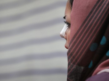 Obsesi Hidung Perempuan Iran
