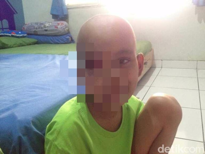 Tubuh Kuning dan Perut Membesar Anak Ini Ternyata Kena 