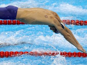 Mengenal Bekam, Terapi Tradisional yang Digemari Para Atlet Olimpiade
