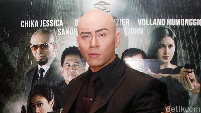 Deddy Corbuzier Sering Dislokasi Bahu, Ini Kemungkinan Penyebabnya