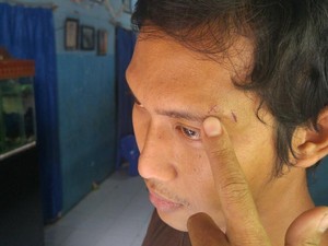 Dipukul Oknum Polisi dengan Revolver, Eko Lapor ke Mapolrestabes Semarang