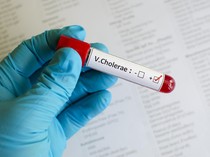 Ngeri! Wabah Kolera Hantui Nigeria, Kasus Tembus 12 Ribu-90 Orang Meninggal