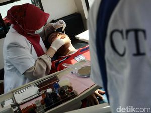 Waduh! Rata-Rata Orang Indonesia Punya 7-8 Gigi Rusak