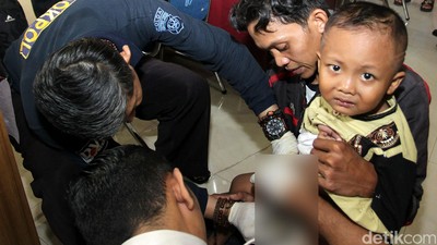 Polres Metro Depok Gelar Operasi Katarak dan Khitanan