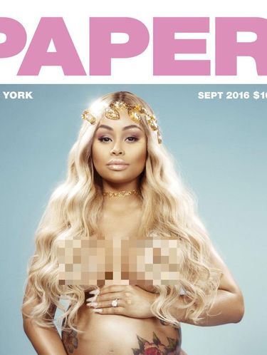 Kesal Diselingkuhi, Rob Kardashian Umbar Foto Seksi Blac Chyna